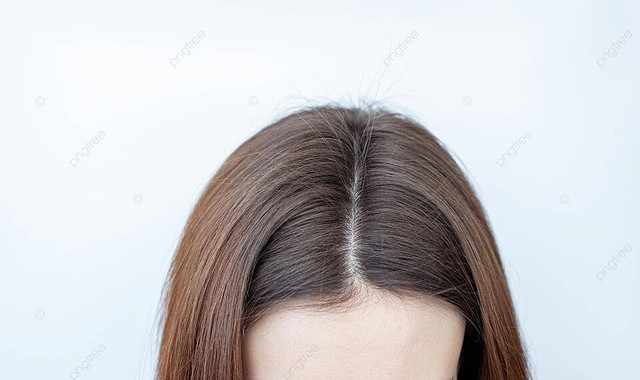 Hair Line
