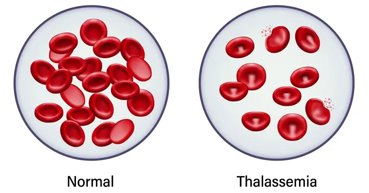Blood or blood-related disorders