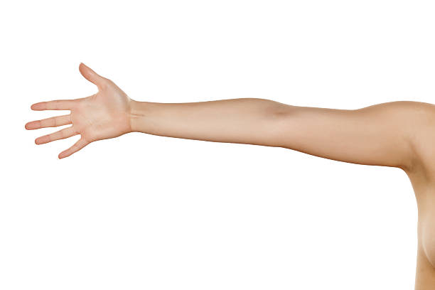 Arm