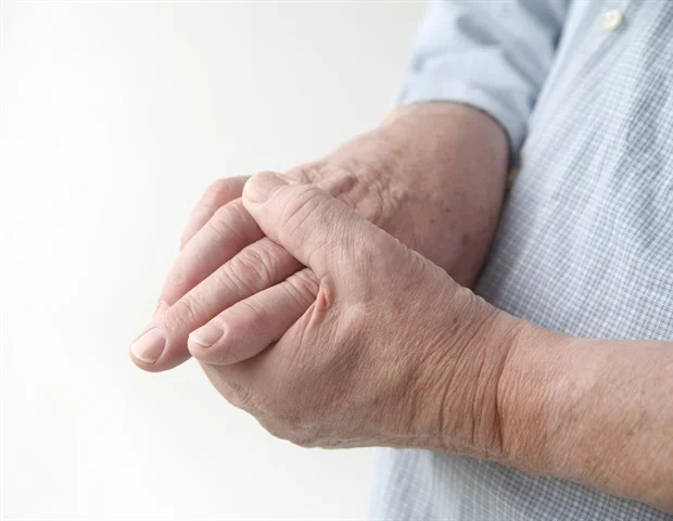 Gout, a kind of Arthritis caused by too much uric acid in the blood