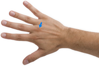 Knuckle