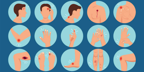 Bleeding from different parts of the body