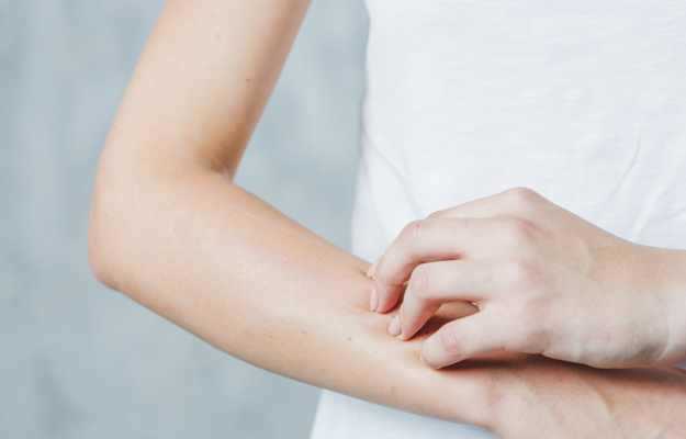 Burning sensation in the Skin
