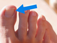 Toe