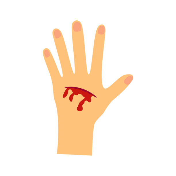 Wound, Injury